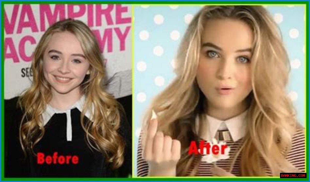 Exploring The Truth: Did Sabrina Carpenter Get A Nose Job?