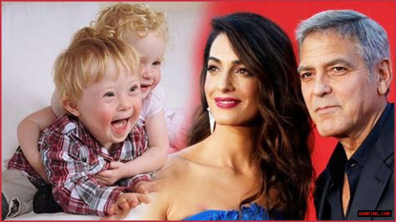 George Clooney's Son: Navigating Life With Down Syndrome